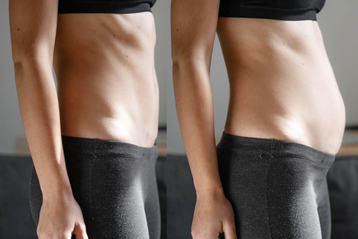 How long does diastasis recti take to improve Stratford New Town?