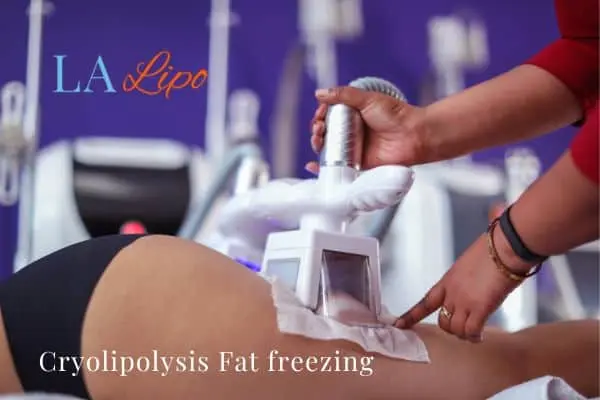 women getting fat freezing Stratford New Town