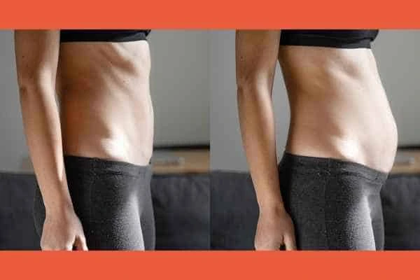 LA-EMS Body Sculpting results Stratford New Town
